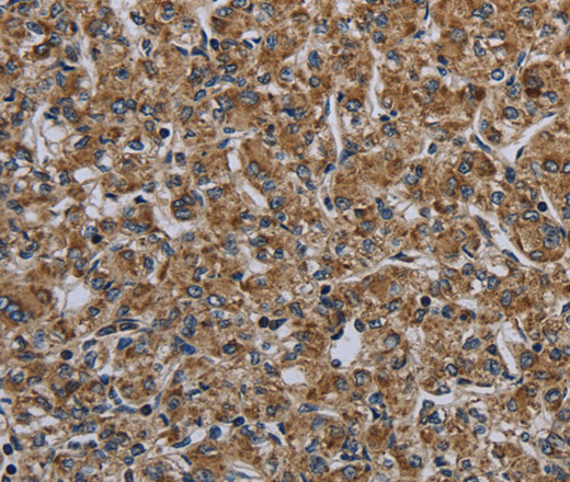 MYO7A Polyclonal Antibody (E-AB-16626)
