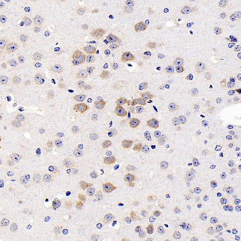 GRIN2B Polyclonal Antibody (E-AB-70263)