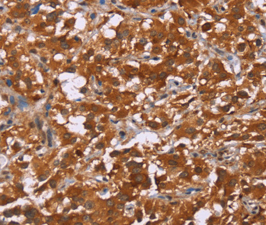 DCBLD2 Polyclonal Antibody (E-AB-11139)