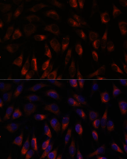 CHP1 Polyclonal Antibody (E-AB-66579)