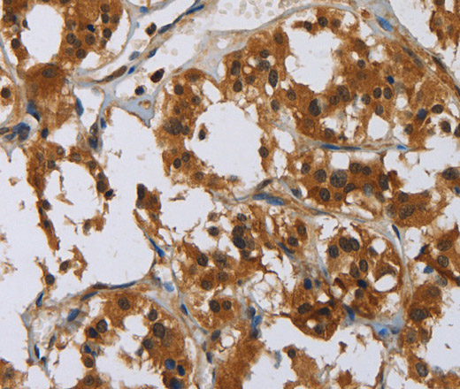 GATA5 Polyclonal Antibody (E-AB-15666)
