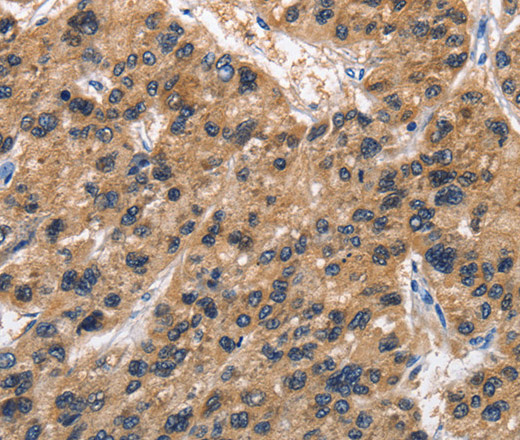 ABI3BP Polyclonal Antibody (E-AB-14758)