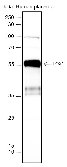 Recombinant OLR1/LOX1 Monoclonal Antibody (AN301759L)