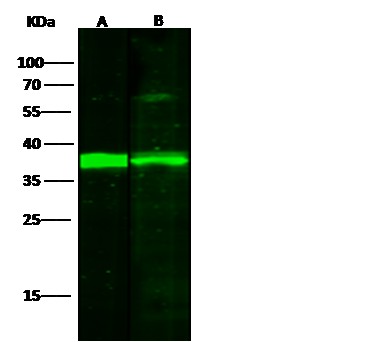 Recombinant IkB alpha/NFKBIA Monoclonal Antibody (AN300411P)