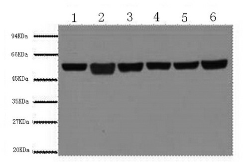beta Tubulin Monoclonal Antibody (E-AB-20033)