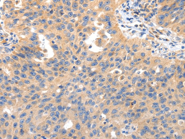 IRS2 Polyclonal Antibody (E-AB-17346)