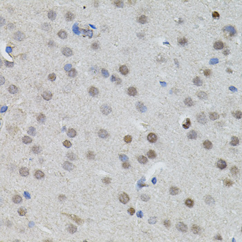 MYCN Polyclonal Antibody (E-AB-62132)