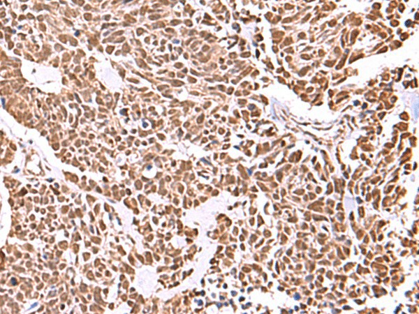 RCOR3 Polyclonal Antibody (E-AB-52952)