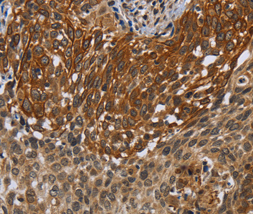UHRF2 Polyclonal Antibody (E-AB-13450)