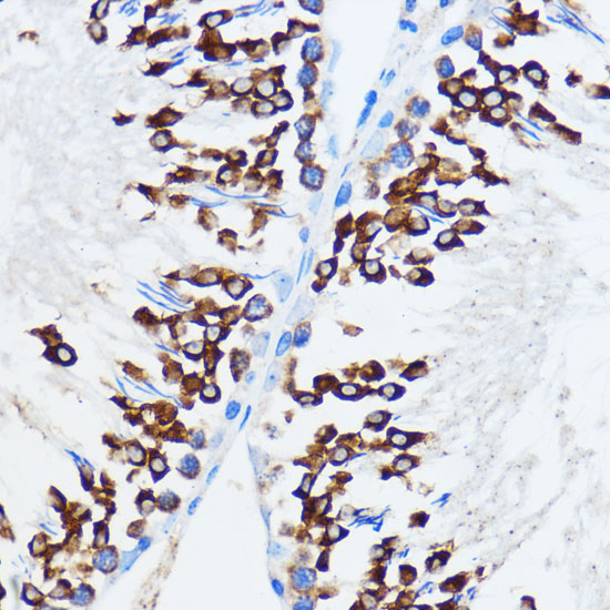 IGF2BP3 Polyclonal Antibody (E-AB-65533)