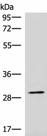CDK4 Polyclonal Antibody (E-AB-52141)