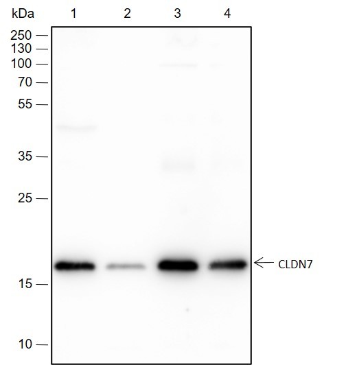 Recombinant Claudin-7 Monoclonal Antibody (AN301493L)