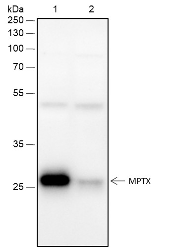 Recombinant MPTX Monoclonal Antibody (AN301603L)