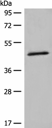 HMBS Polyclonal Antibody (E-AB-18691)