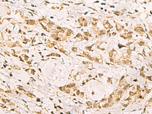 PDS5A Polyclonal Antibody (E-AB-52893)