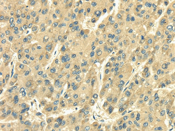 SDF4 Polyclonal Antibody (E-AB-17011)
