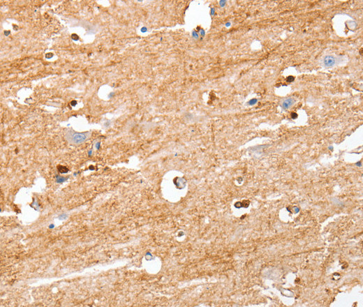 S100B Polyclonal Antibody (E-AB-13042)