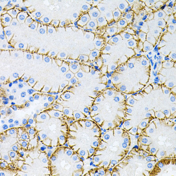 Tau Polyclonal Antibody (E-AB-60186)