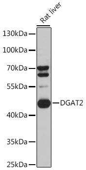 DGAT2 Polyclonal Antibody (E-AB-90707)