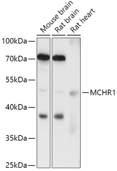 MCHR1 Polyclonal Antibody (E-AB-91974)