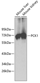 PCK1 Polyclonal Antibody (E-AB-60569)