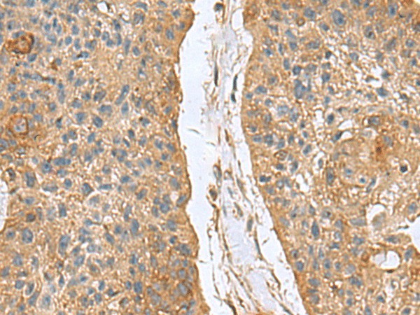 MARCKSL1 Polyclonal Antibody (E-AB-53073)