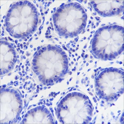 Recombinant Napsin A Monoclonal Antibody (AN301609L)