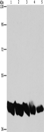 PGK1 Polyclonal Antibody (E-AB-14734)