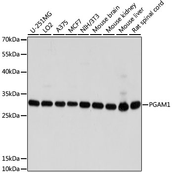 PGAM1 Polyclonal Antibody (E-AB-62865)