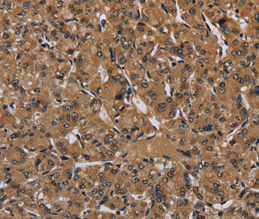 HIF1 alpha Polyclonal Antibody (E-AB-11289)
