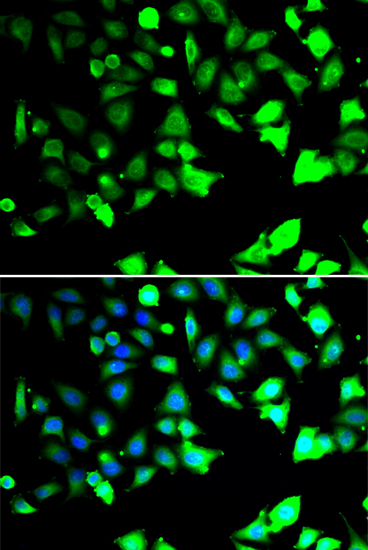 XIAP Polyclonal Antibody (E-AB-64526)