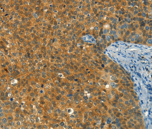 DIRAS1 Polyclonal Antibody (E-AB-16393)