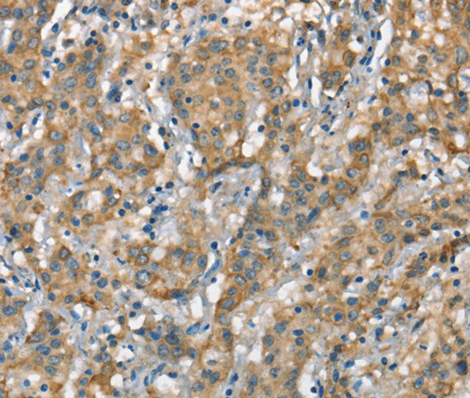 CSMD1 Polyclonal Antibody (E-AB-16364)