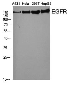 EGFR Polyclonal Antibody (E-AB-31291)