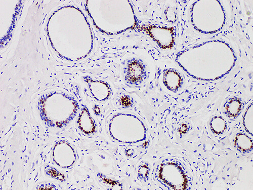 PR Monoclonal Antibody (ELAB6666-M)