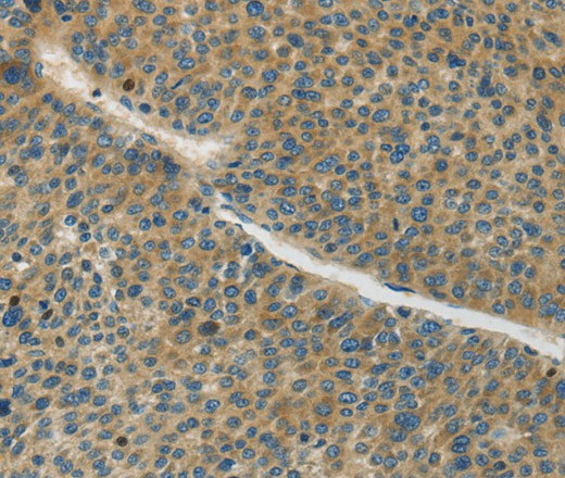Connexin-45 Polyclonal Antibody (E-AB-16352)