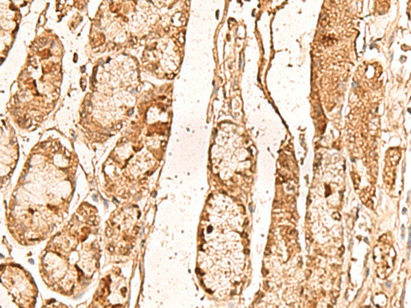 WDR33 Polyclonal Antibody (E-AB-18978)