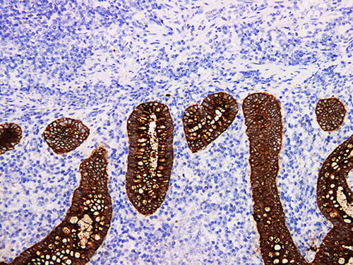 CEA Monoclonal Antibody (ELAB6026-M)