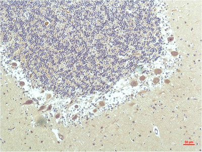 PPARD Monoclonal Antibody (E-AB-22199)