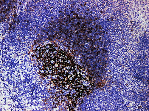 CD23 Monoclonal Antibody (ELAB6151-M)
