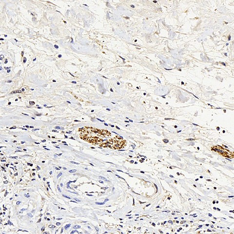 ENO2 Polyclonal Antibody (E-AB-70269)