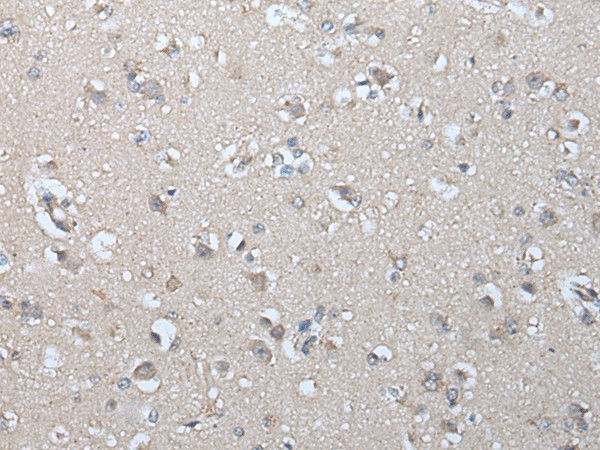 IFNB1 Polyclonal Antibody (E-AB-53491)