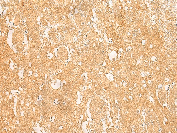 ARPC5L Polyclonal Antibody (E-AB-52815)