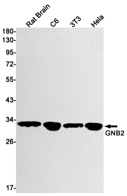 Recombinant GNB2 Monoclonal Antibody (E-AB-81563)