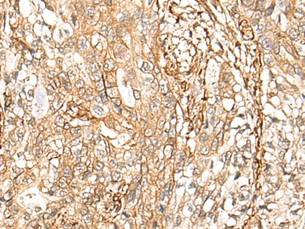 CD99 Polyclonal Antibody (E-AB-52527)