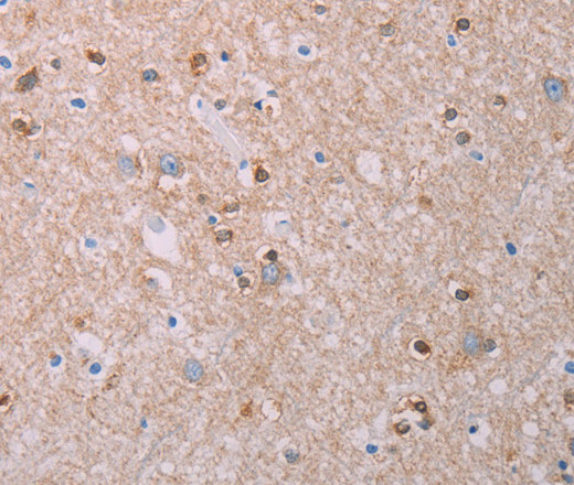 AKT2 Polyclonal Antibody (E-AB-16142)