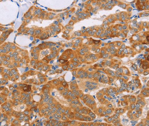 CARD6 Polyclonal Antibody (E-AB-13111)