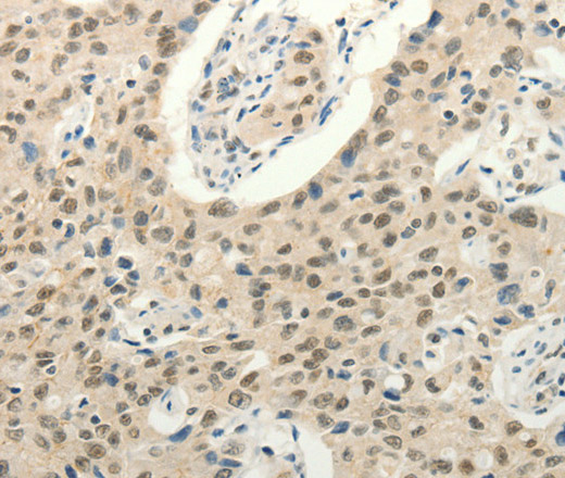 Frizzled 10 Polyclonal Antibody (E-AB-16119)