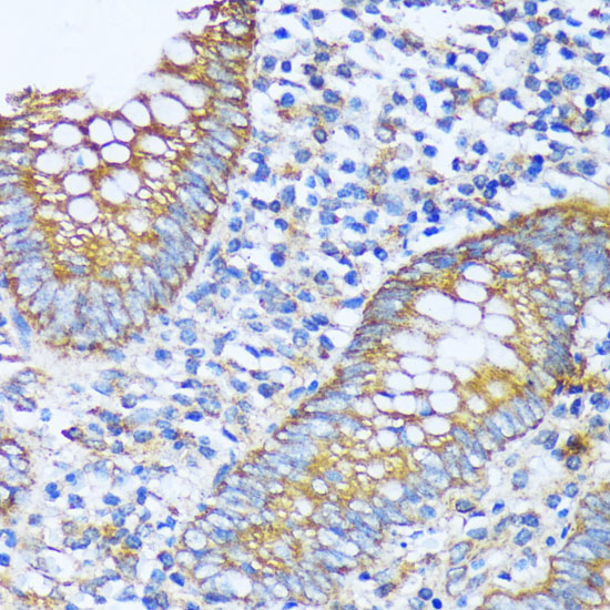 ACOT2 Polyclonal Antibody (E-AB-64995)