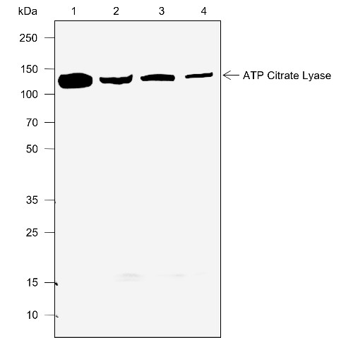 Recombinant ATP Citrate Lyase Monoclonal Antibody (AN302052L)